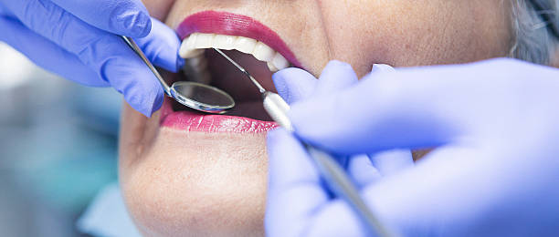 Best Emergency Tooth Extraction in Winsted, CT